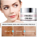 Factory Professional Pigmentflecken-Entferner-Hautaufhellungscreme Sommersprossen-Creme